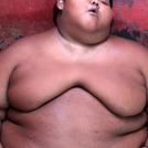 Фото Самый тяжелый в мире ребенок (16 фото) из раздела  /