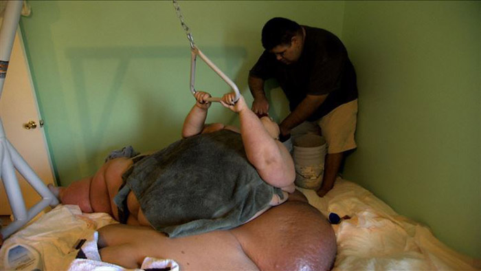 Фото Женщина с весом 470 килограмм похудела на 80% из раздела  /