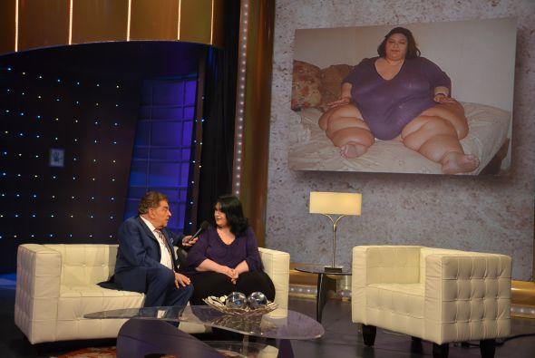 Фото Женщина с весом 470 килограмм похудела на 80% из раздела  /