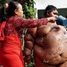 Фото Самый тяжелый в мире ребенок (16 фото) из раздела  /