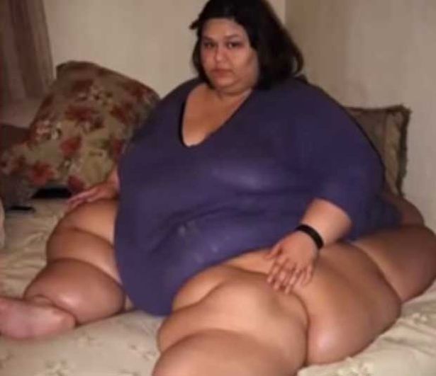 Фото Женщина с весом 470 килограмм похудела на 80% из раздела  /