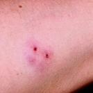 Фото Далеко не всегда укус убивает из раздела  /