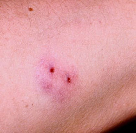 Фото Далеко не всегда укус убивает из раздела  /