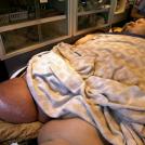 Фото Женщина с весом 470 килограмм похудела на 80% из раздела  /