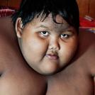 Фото Самый тяжелый в мире ребенок (16 фото) из раздела  /