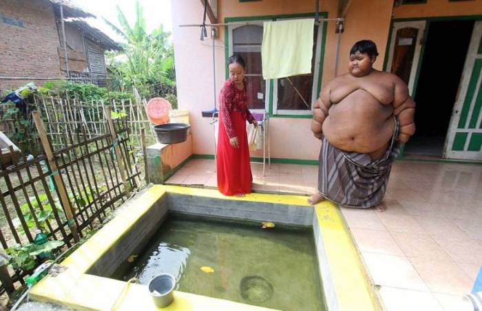 Самый тяжелый в мире ребенок (%%items%% фото)