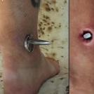 Штырь в ноге. А через дырку можно даже смотреть