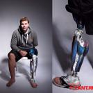 Фото Быть киборгом и гордиться этим: стильные протезы для инвалидов (11 фото) из раздела /