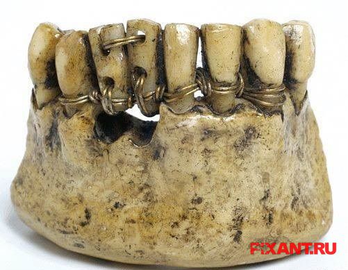 Самые интересные зубные традиции и ритуалы Фото Самые интересные зубные традиции и ритуалы из раздела Самые факты / unlinked