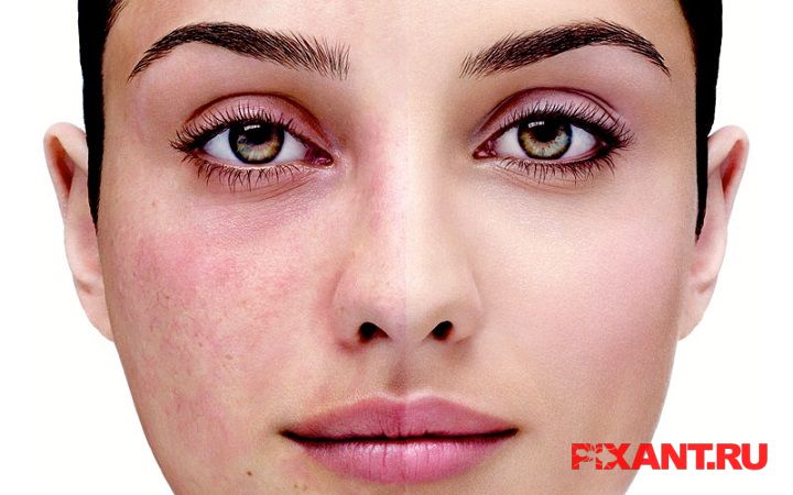 Все о клинике Дека в Москве Фото Все о клинике Дека в Москве из раздела Исследование / ad