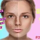 Как избавиться от веснушек?